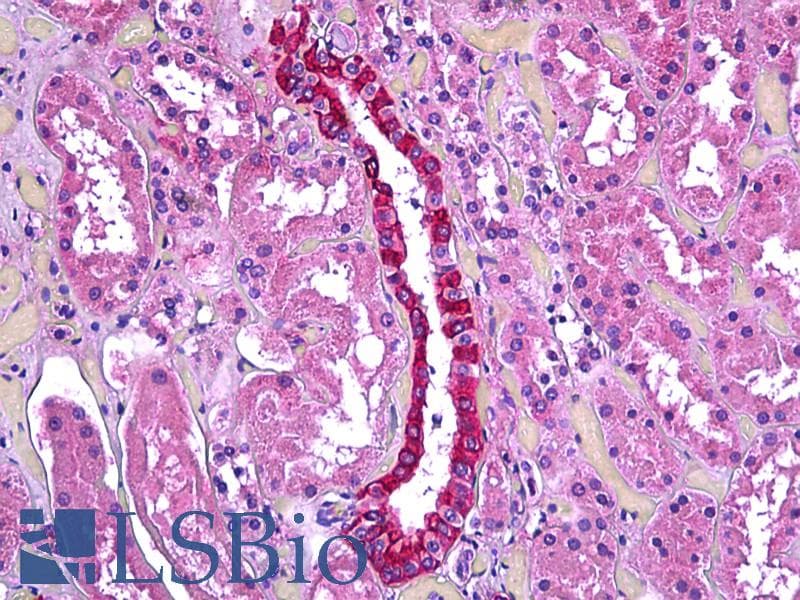 IHC-plus™ TGFBI Antibody (aa119-131)