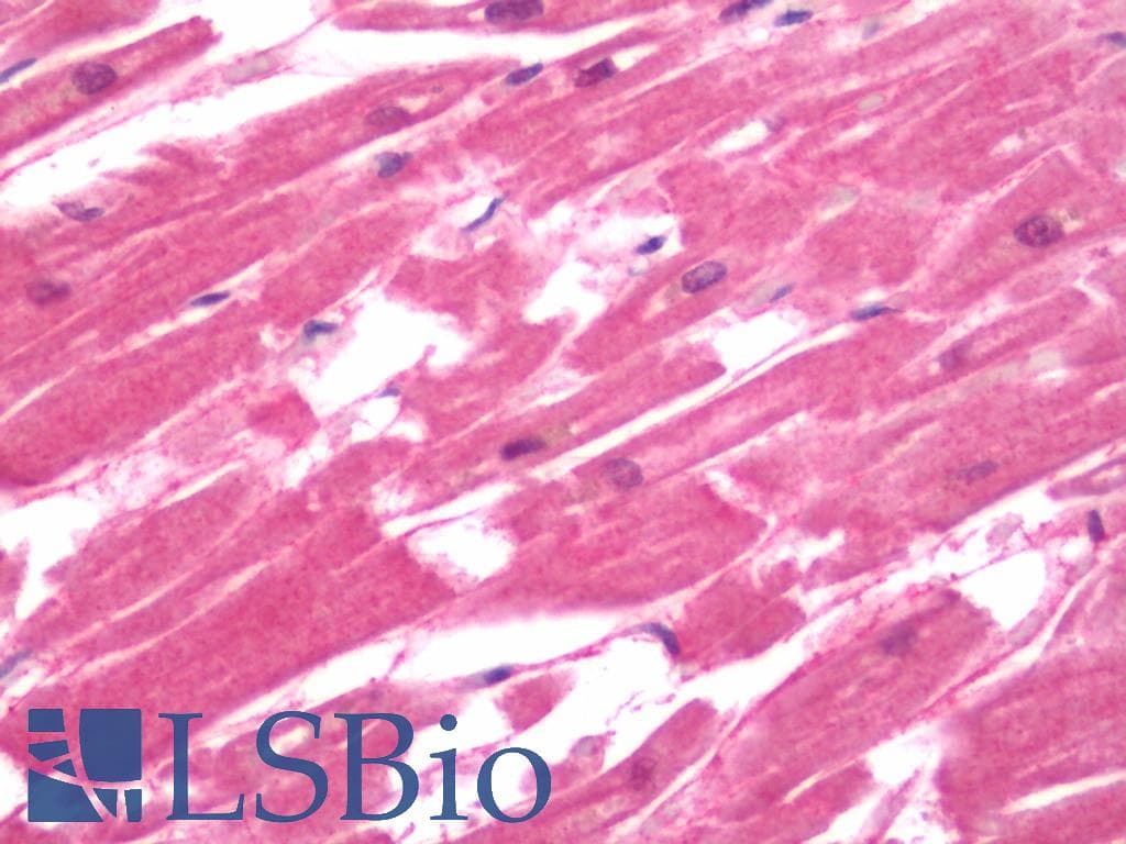 IHC-plus™ CACNA1H / Cav3.2 Antibody