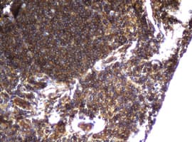CCDC93 Antibody (aa293-631, clone OTI6E11, Carrier-free)