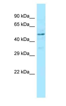 Polyclonal Rabbit anti-Human RENBP Antibody (aa325-374, WB)