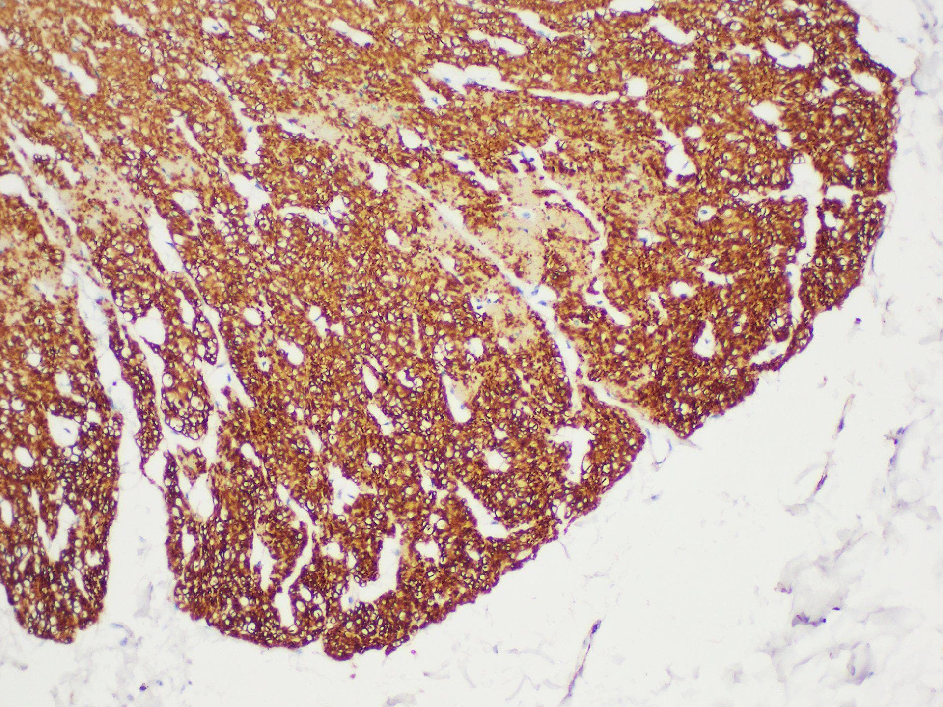 ACTA2 / Smooth Muscle Actin Antibody