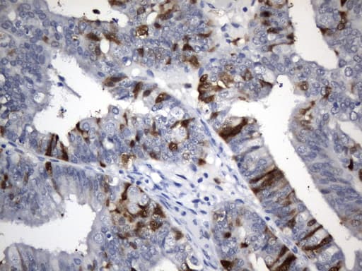 TS / Thymidylate Synthase Antibody (clone UMAB227, Carrier-free)