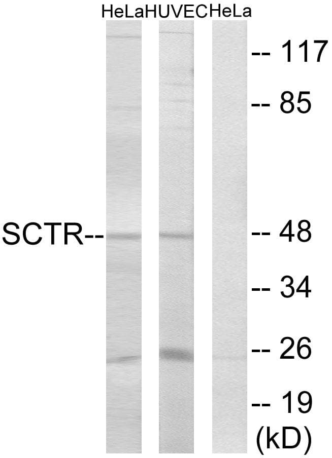 SCTR / SR / Secretin Receptor Antibody