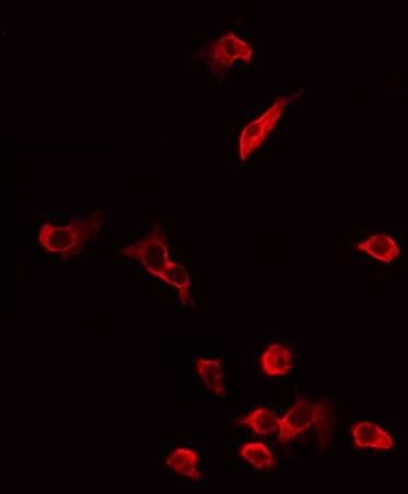 Polyclonal Rabbit anti-Human ATP5A1 / ATP Synthase Alpha Antibody (IF, WB)