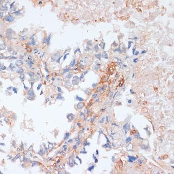 EIF4EBP1 / 4EBP1 Antibody