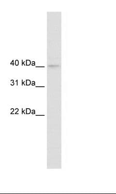 NUDT9 Antibody (aa121-170)