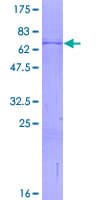 Human ST3GAL3 / ST3N Protein (Recombinant GST)