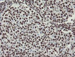 NONO / P54NRB Antibody (clone OTI2C9)