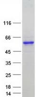 Human PPP1R3G Protein (Recombinant Myc-DDK (Flag))