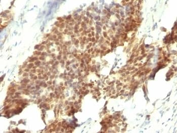 ESR2 / ER Beta Antibody (C-Terminus, clone ESR2/686, Ready-to-Use)