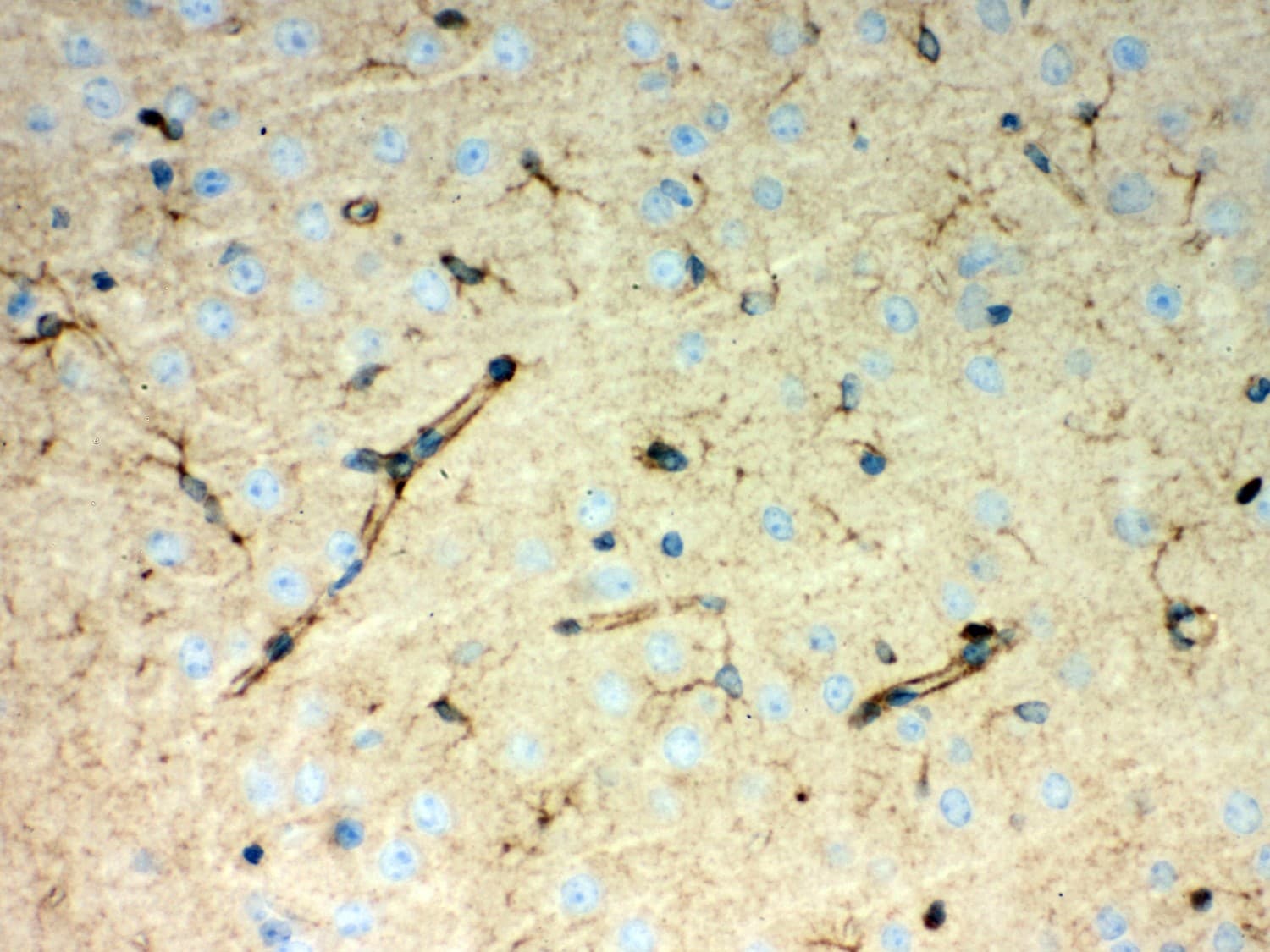 PRDX1 / Peroxiredoxin 1 Antibody (aa100-128)