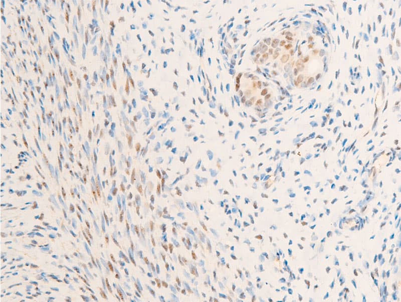 NR3C1/Glucocorticoid Receptor Antibody (phospho-Ser226)