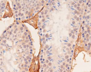 YAP / YAP1 Antibody (phospho-Ser127)