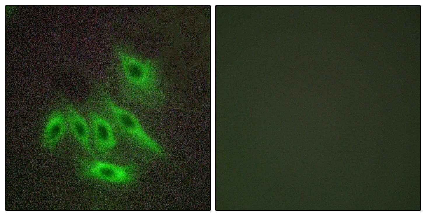 Polyclonal Rabbit anti-Human MUC16 / CA125 Antibody (IF)
