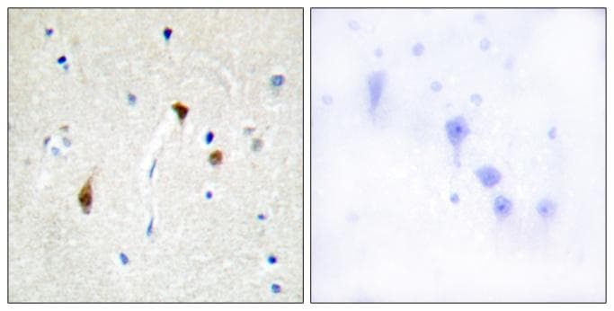Hairless / HR Antibody