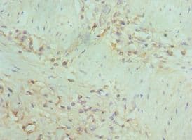 IHC-plus™ Polyclonal Rabbit anti-Human MAP2K5 / MEK5 Antibody (aa1-190, IHC)
