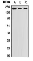 Polyclonal Rabbit anti-Human LAMB1 / Laminin Beta 1 Antibody (C-Terminus, IHC, WB)