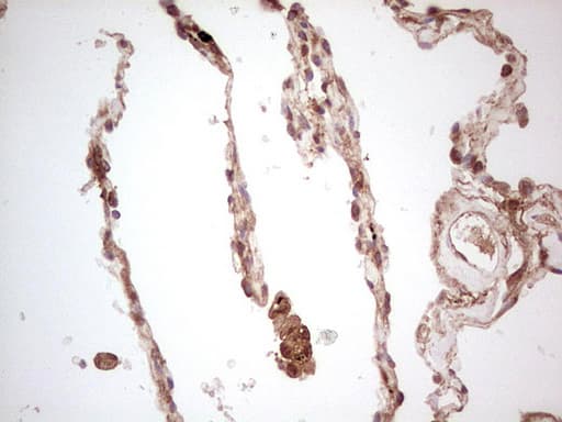 UBE2D2 / UBCH5B Antibody (clone OTI2C2)