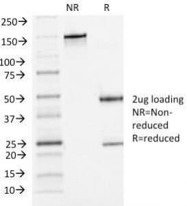 CDH3 / P-Cadherin Antibody (clone 6A9)