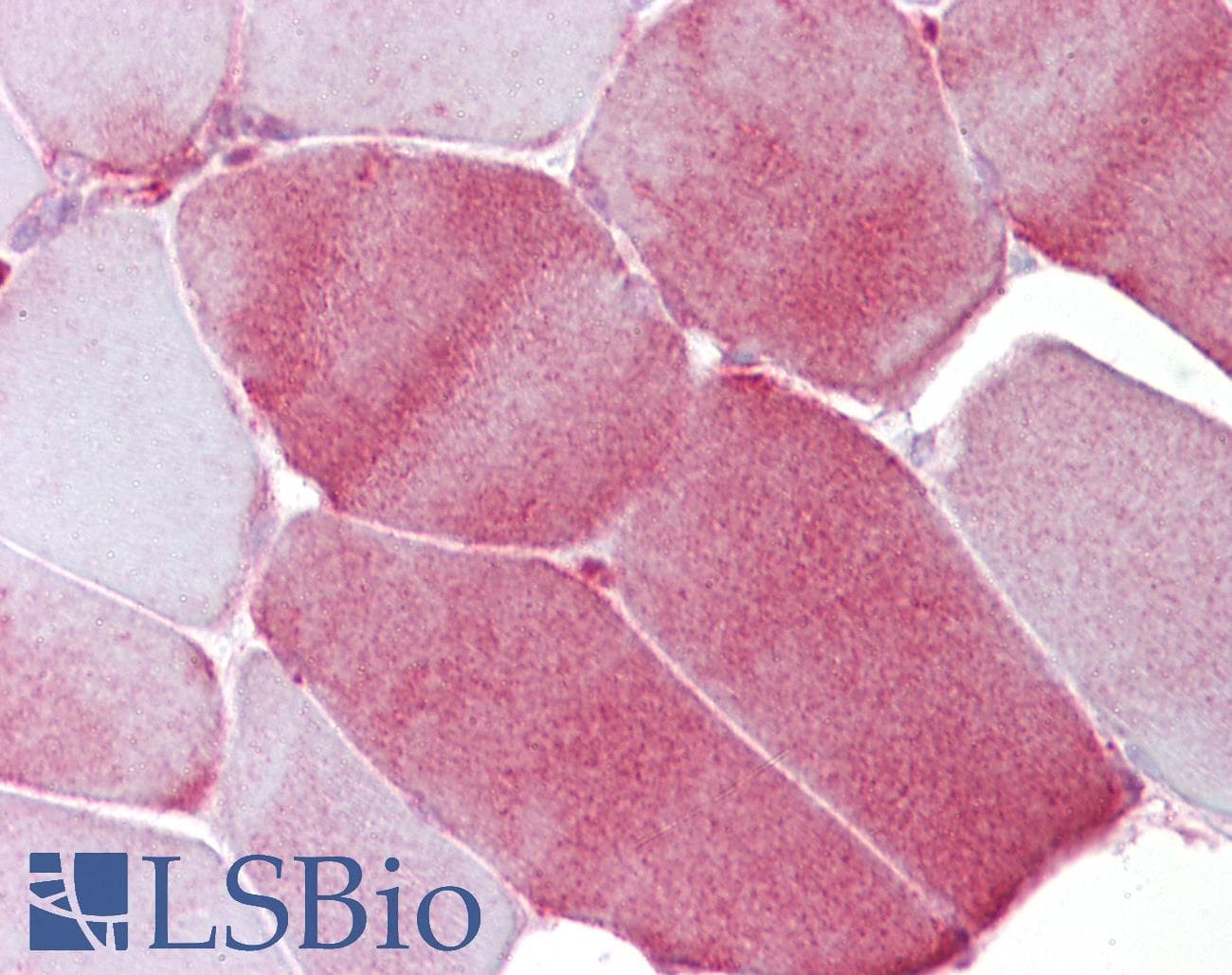 PathPlus™ FABP3 / H-FABP Antibody (aa72-121)