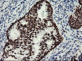MLF1 Antibody (clone OTI3A3)