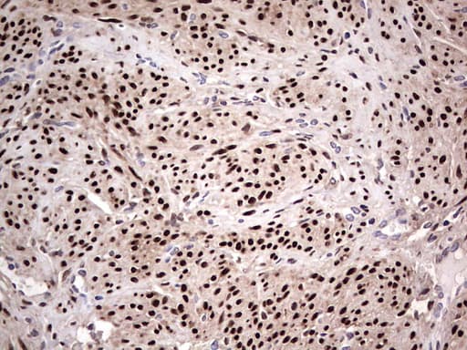 Monoclonal Mouse anti-Human PR / Progesterone Receptor Antibody (clone OTI31D9, aa1-298, IHC)