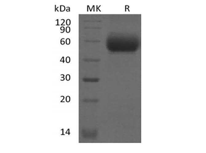 Mouse IL1RL2 Protein (Recombinant 6His, C-terminus)