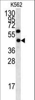 LYAR Antibody (aa38-66)