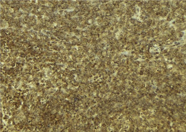 DRAK1 / STK17A Antibody