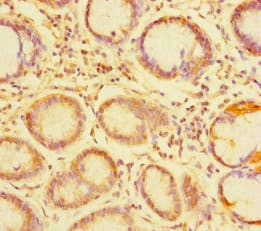TDRD1 Antibody