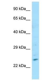 ZNF846 Antibody (aa7-56)