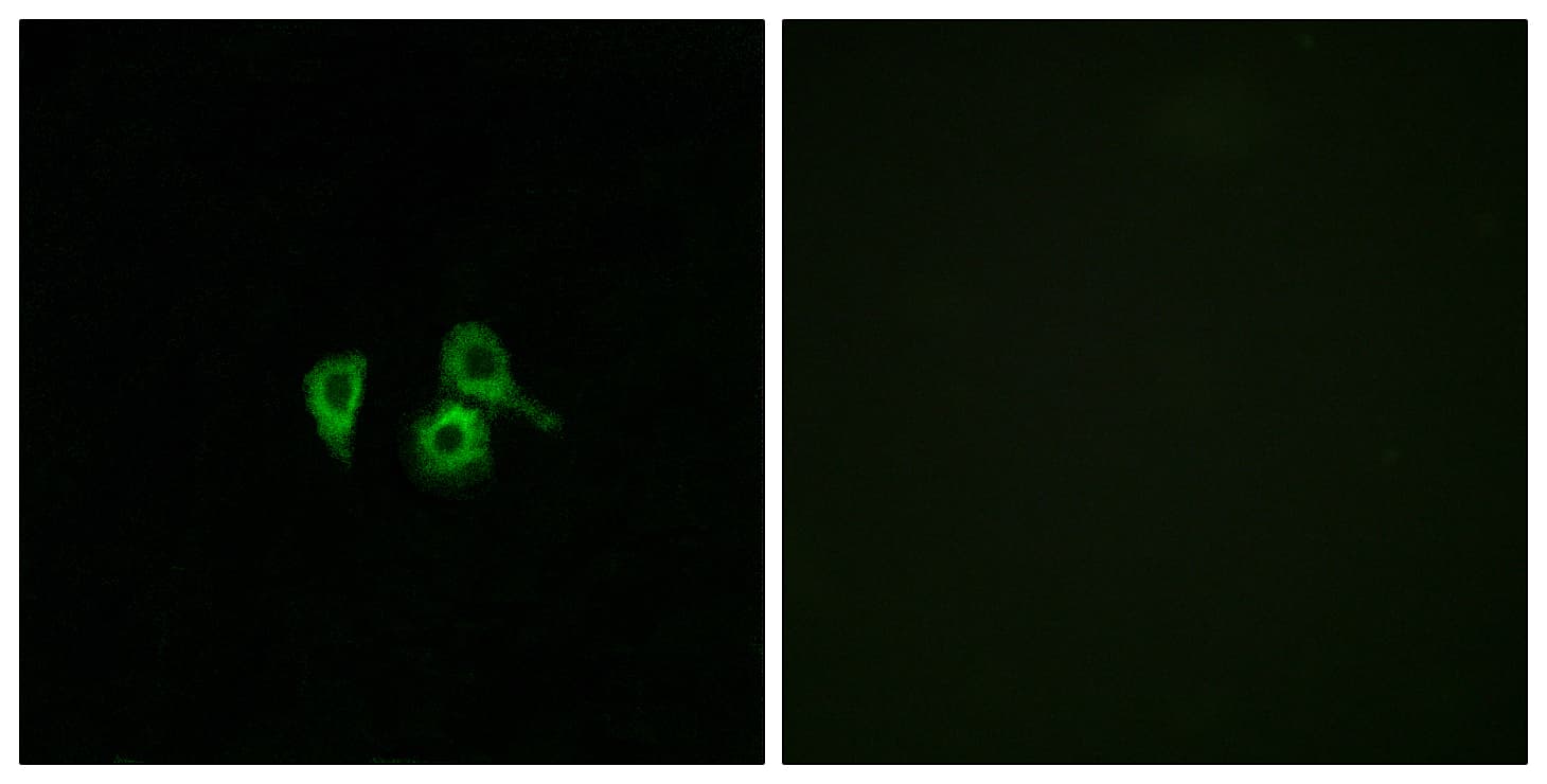 OR10H4 Antibody (aa161-210)
