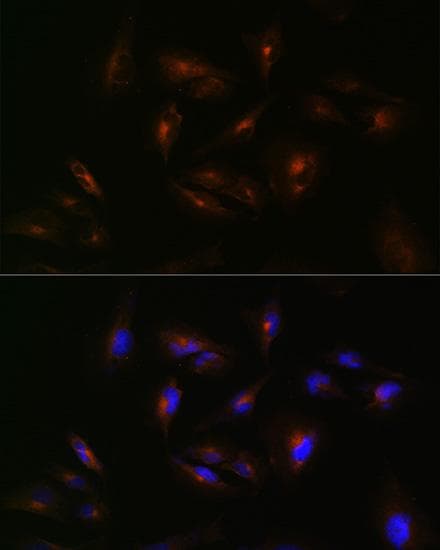 ABCA2 Antibody