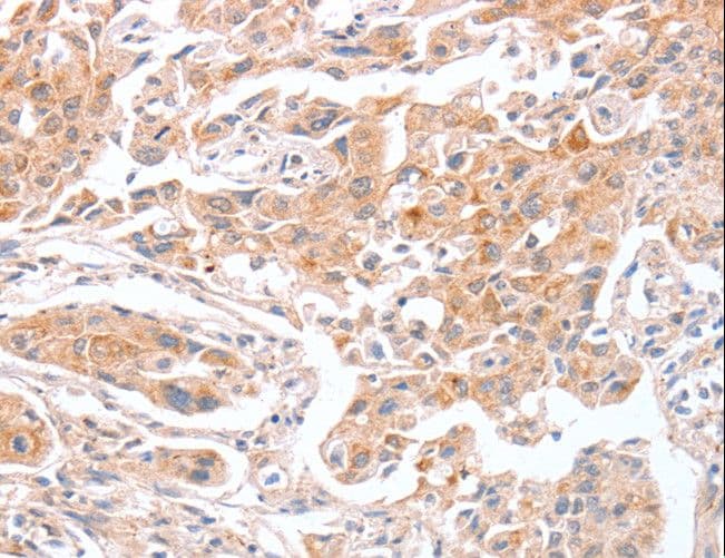Polyclonal Rabbit anti-Human ABO Glycosyltransferase Antibody (IHC)