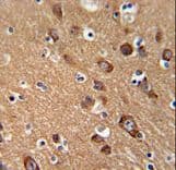 SYT13 Antibody (aa25-52)