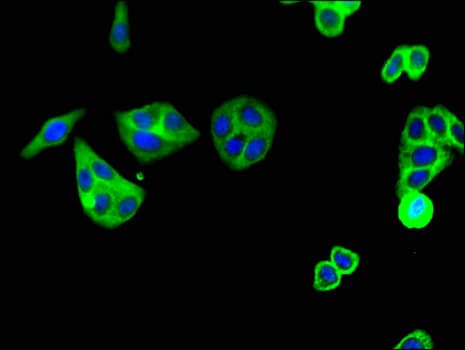 C5AR1 / CD88 / C5a Receptor Antibody
