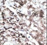 Polyclonal Rabbit anti-Human PAEL Receptor / GPR37 Antibody (aa217-246, IHC, WB)
