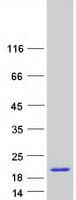 Human DAP Protein (Recombinant Myc-DDK (Flag))
