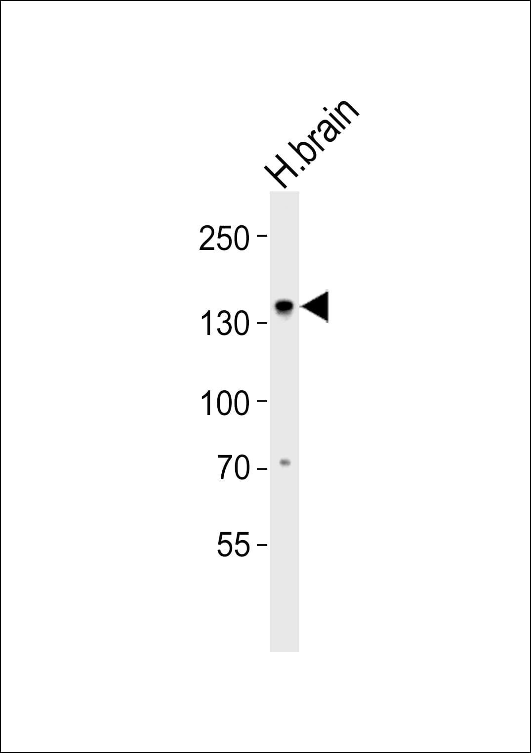 OVOS / Ovostatin Antibody (aa561-595)