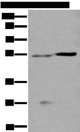 DDC / DOPA Decarboxylase Antibody