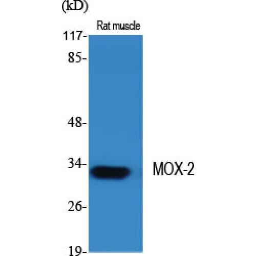 Polyclonal Rabbit anti-Human GAX / MEOX2 Antibody (120-200 aa, Internal, IHC, WB)