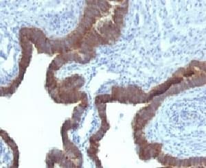 KRT7 / CK7 / Cytokeratin 7 Antibody (clone KRT7/903)
