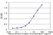 BAF53 / ACTL6A Antibody (clone 3C4)