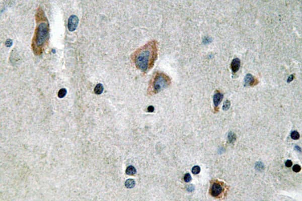 KRT14 / CK14 / Cytokeratin 14 Antibody (aa102-151)