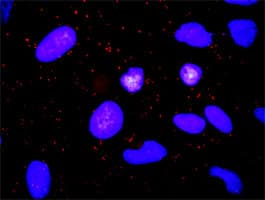 IHC-plus™ ADAM17 / TACE Antibody (clone 1F6)