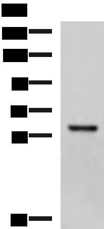 MYOT / Myotilin Antibody