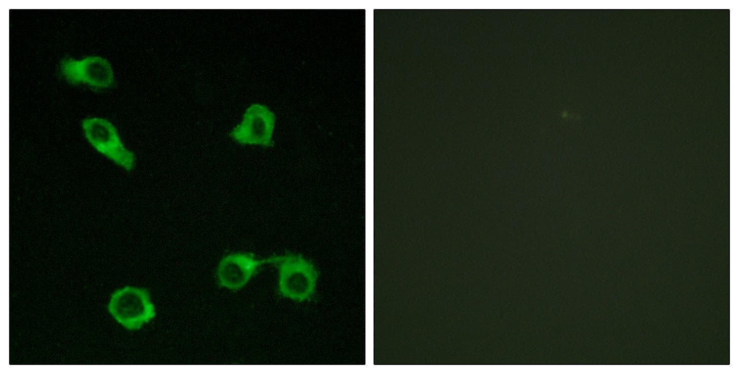 PTGER3 / EP3 Antibody