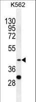 Polyclonal Rabbit anti-Human SERPINB4 / SCCA1+2 Antibody (aa268-296, WB)