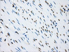 LOX / Lysyl Oxidase Antibody (clone OTI8G5)