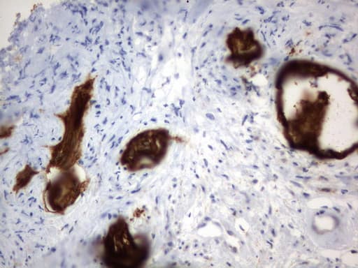 CD44 Antibody (clone UMAB134)